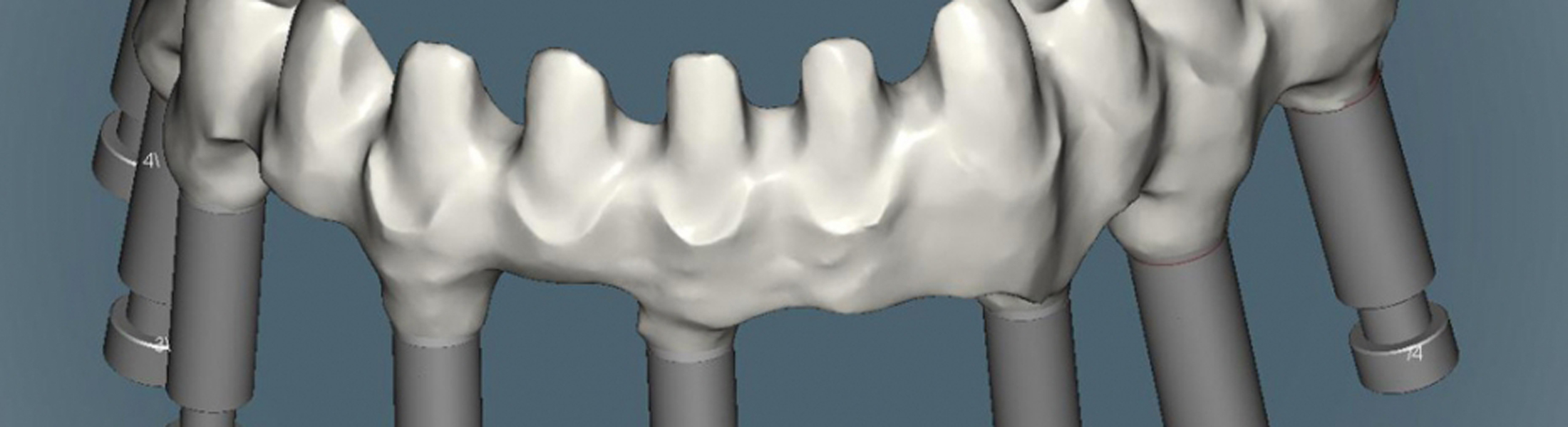 CAD-CAM Technologie